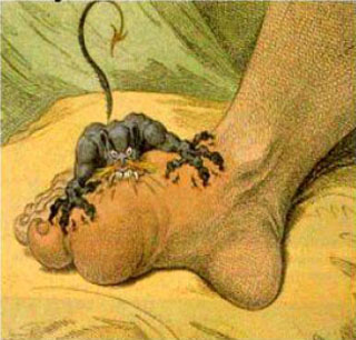 Illustration of Gout as a devil attacking a foot