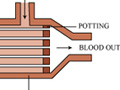 An illustration of a hollow fiber membrane hemodialyzer.  The illustration calls out important features of the device as well as the indicating the flow of fluids.