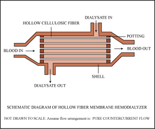 An illustration of a hollow fiber membrane hemodialyzer.  The illustration calls out important features of the device as well as the indicating the flow of fluids.