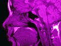 A brain scan image.