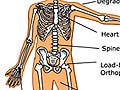 Diagram of the human body with locations for biomaterial applications.
