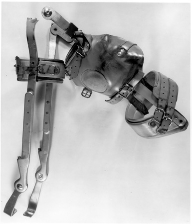 Photo of fractured leg brace.