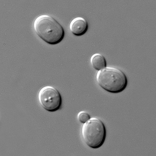 Black and white photograph showing budding yeast cells under a microscope.