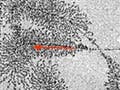 Electron micrograph showing transcription of ribosomal RNA genes.