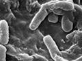Black and white micrograph of P. aeruginosa.