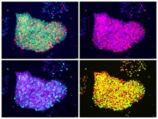 Four different views of a collection of cells, shown in four different fluorescent colors. Clockwise from upper left, they are: green, pink, purple, and yellow.