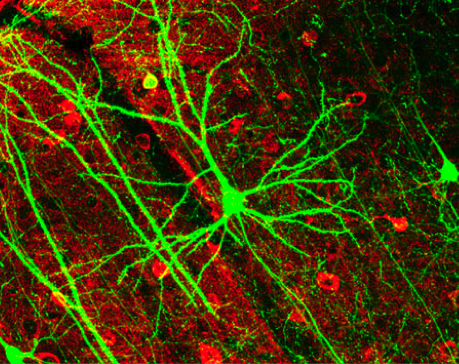 Bright green branches at the end of a nerve cell, against a red background.