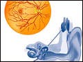 Drawing of a human retina on the left and a drawing of the human ear with a cochlear implant on the right.