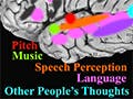 Labeled image of a human cortex with regions marked with different colors.