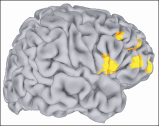 Image of the brain with key areas highlighted.