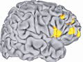 Image of the brain with key areas highlighted.