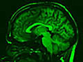 An image of a  Midsaggital brain scan of a human.