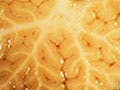 A side-by-side comparison of the cerebellar cortex and the neocortex.
