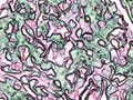 Artistic rendition of a kidney glomerulus.