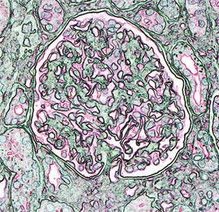 Artistic rendition of a kidney glomerulus.