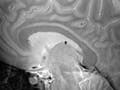 An MRI image of a human brain.