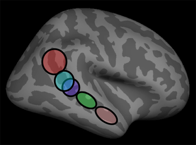 Diagram of the human brain, with 5 subregions highlighted along the temporal lobe.