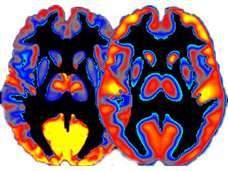 Multi-color images of two slices of the human brain.