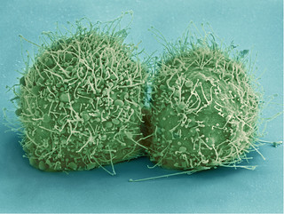 An image of a divided cell under an electronic micrograph. Each half is green and roundish with many hair-like protrusions extending off of them. 