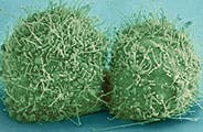 An image of a divided cell under an electronic micrograph. Each half is green and roundish with many hair-like protrusions extending off of them. 