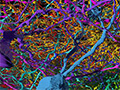 Colorful neurons are tangled around each other. 